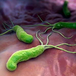 helicobacter-pylori-s3-cause