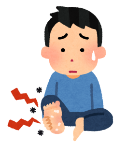 水虫に悩んでいる男性